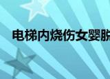 电梯内烧伤女婴脱险 女婴现在是什么情况
