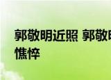 郭敬明近照 郭敬明最近什么样子为什么那么憔悴