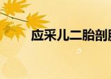 应采儿二胎剖腹产过 场面令人揪心