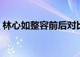 林心如整容前后对比图片（林心如整容前后）