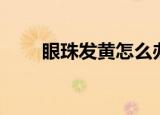 眼珠发黄怎么办（眼珠发黄怎么办）