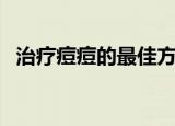 治疗痘痘的最佳方法（治痘痘最好的方法）