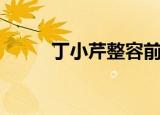 丁小芹整容前后（丁小芹孙协志）