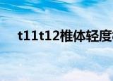 t11t12椎体轻度楔形变严重吗（t11te）