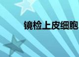 镜检上皮细胞2+（镜检上皮细胞）