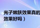 光子嫩肤效果真的比护肤品明显吗（光子嫩肤效果好吗）