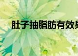 肚子抽脂肪有效果吗（肚子脂肪怎么抽）