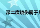 深二度烧伤属于几级伤残（深二度烧伤）
