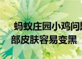  蚂蚁庄园小鸡问题：常进行以下哪种活动手部皮肤容易变黑