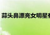 蒜头鼻漂亮女明星有谁（蒜头鼻漂亮女明星）