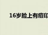 16岁脸上有痘印怎么办（痘印怎么办）