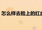 怎么样去脸上的红血丝（怎么去脸上红血丝）