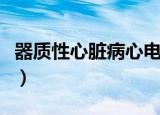 器质性心脏病心电图能查出来（器质性心脏病）
