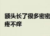 额头长了很多密密麻麻的小痘痘是什么原因不疼不痒