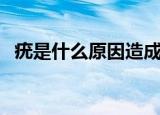 疣是什么原因造成的怎么治疗（疣是什么）