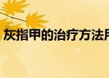 灰指甲的治疗方法用醋（灰指甲的治疗方法）
