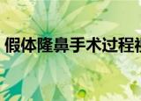 假体隆鼻手术过程视频（假体隆鼻手术过程）