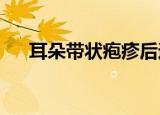 耳朵带状疱疹后遗症神经痛的治疗方法