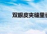 双眼皮夹缝里长一颗痣（双眼皮夹）