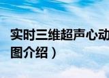 实时三维超声心动图（关于实时三维超声心动图介绍）