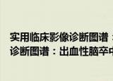 实用临床影像诊断图谱：出血性脑卒中（关于实用临床影像诊断图谱：出血性脑卒中介绍）
