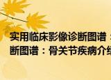 实用临床影像诊断图谱：骨关节疾病（关于实用临床影像诊断图谱：骨关节疾病介绍）