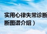 实用心律失常诊断图谱（关于实用心律失常诊断图谱介绍）