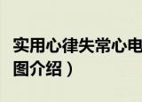 实用心律失常心电图（关于实用心律失常心电图介绍）