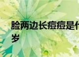 脸两边长痘痘是什么原因引起的吗我女儿12岁