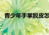 青少年手掌脱皮怎么办（手掌脱皮怎么办）