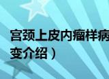 宫颈上皮内瘤样病变（关于宫颈上皮内瘤样病变介绍）