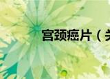 宫颈癌片（关于宫颈癌片介绍）