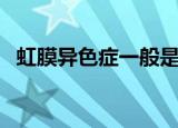 虹膜异色症一般是什么颜色（虹膜异色症）