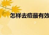 怎样去痘最有效的方法（去痘的办法）