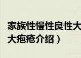 家族性慢性良性大疱疮（关于家族性慢性良性大疱疮介绍）