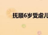 抚顺6岁受虐儿童父亲希望严惩前妻