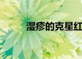 湿疹的克星红霉素软膏（湿疹清）