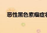 恶性黑色素瘤症状（恶性黑色素瘤症状）