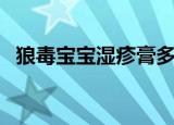 狼毒宝宝湿疹膏多少钱（狼毒宝宝湿疹膏）