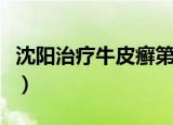 沈阳治疗牛皮癣第一的医院（广州牛皮癣医院）