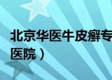 北京华医牛皮癣专家张美英（北京华医牛皮癣医院）