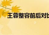 王蓉整容前后对比图片（王蓉整容前后）