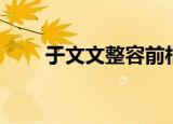 于文文整容前相片（于文文整容前）