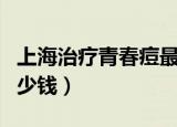 上海治疗青春痘最好医院（上海治疗青春痘多少钱）