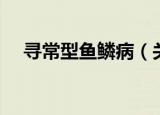 寻常型鱼鳞病（关于寻常型鱼鳞病介绍）