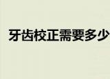 牙齿校正需要多少钱17岁（牙齿校正价格）