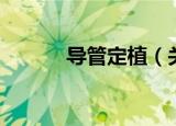 导管定植（关于导管定植介绍）