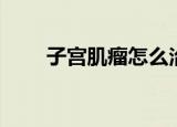 子宫肌瘤怎么治疗才好（子桓哥哥）