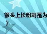 额头上长粉刺是为什么（额头上长粉刺怎么办）