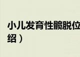 小儿发育性髋脱位（关于小儿发育性髋脱位介绍）